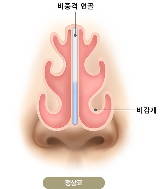 정상코